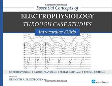 Essential Concepts of Electrophysiology through Case Studies: Intracardiac EGMs