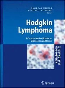 Hodgkin Lymphoma: A Comprehensive Update on Diagnostics and Clinics