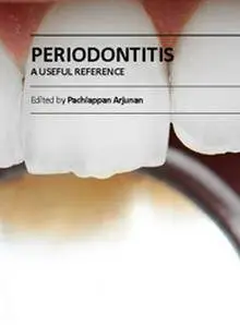 "Periodontitis: A Useful Reference" ed. by Pachiappan Arjunan