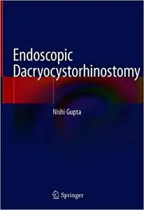 Endoscopic Dacryocystorhinostomy