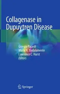 Collagenase in Dupuytren Disease (Repost)