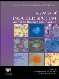 An Atlas of Induced Sputum: An Aid for Research and Diagnosis (Encyclopedia of Visual Medicine Series) by Ratko. Djukanovic