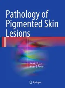 Pathology of Pigmented Skin Lesions (Repost)