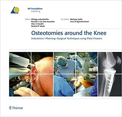 Osteotomies Around The Knee Indications Planning Surgical