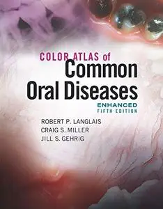 Color Atlas of Common Oral Diseases, Enhanced Edition, 5th Edition