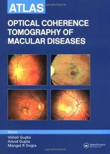 Atlas of Optical Coherence Tomography of Macular Diseases