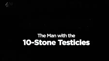 Channel 4 - Man with the 10 Stone Testicles (2013)