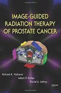 Image-Guided Radiation Therapy of Prostate Cancer (Repost)