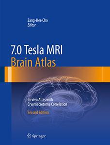 7.0 Tesla MRI Brain Atlas: In-vivo Atlas with Cryomacrotome Correlation (Repost)