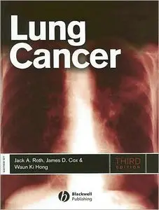Lung Cancer (repost)