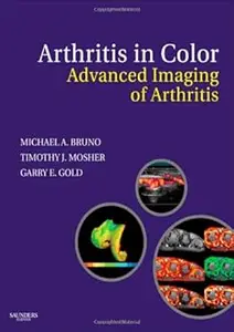 Arthritis in Color: Advanced Imaging of Arthritis