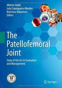 The Patellofemoral Joint: State of the Art in Evaluation and Management