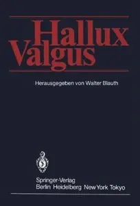 Hallux Valgus