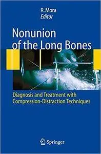 Nonunion of the Long Bones: Diagnosis and treatment with compression-distraction techniques (Repost)