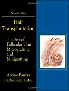 Hair Transplantation: The Art of Micrografting and Minigrafting (2nd Edition) (Repost)