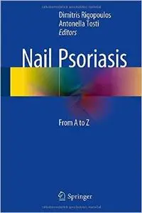 Nail Psoriasis: From A to Z