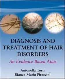 Diagnosis and Treatment of Hair Disorders: An Evidence-Based Atlas 