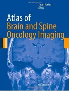Atlas of Brain and Spine Oncology Imaging [Repost]