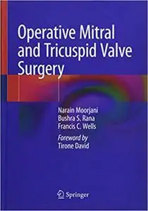 Operative Mitral and Tricuspid Valve Surgery