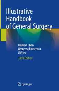 Illustrative Handbook of General Surgery
