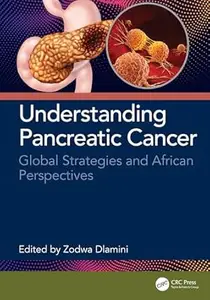 Understanding Pancreatic Cancer