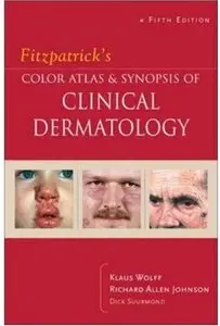 Fitzpatrick's Color Atlas & Synopsis of Clinical Dermatology (5th edition)