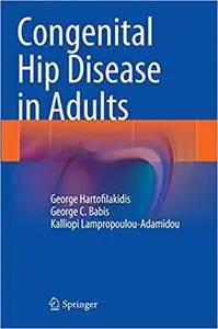 Congenital Hip Disease in Adults