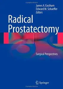 Radical Prostatectomy: Surgical Perspectives