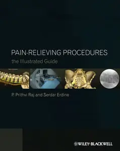 Pain-Relieving Procedures: The Illustrated Guide (repost)
