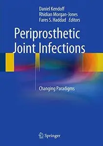 Periprosthetic Joint Infections: Changing Paradigms [Repost]