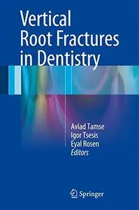 Vertical Root Fractures in Dentistry Vertical Root Fractures in Dentistry