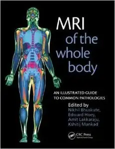 MRI of the Whole Body: An Illustrated Guide for Common Pathologies: An Illustrated Guide to Common Pathologies (repost)