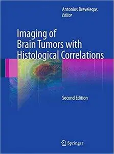 Imaging of Brain Tumors with Histological Correlations Ed 2