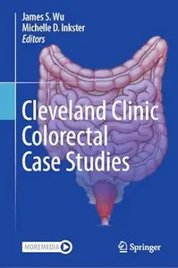 Cleveland Clinic Colorectal Case Studies