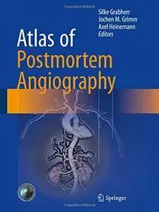 Atlas of Postmortem Angiography (repost)