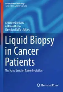 Liquid Biopsy in Cancer Patients: The Hand Lens for Tumor Evolution