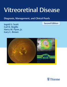 Vitreoretinal Disease : Diagnosis, Management, and Clinical Pearls, Second Edition