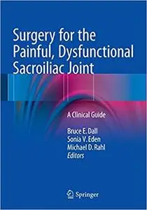 Surgery for the Painful, Dysfunctional Sacroiliac Joint: A Clinical Guide