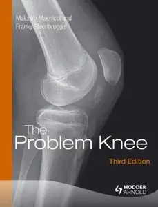 The Problem Knee, Third Edition (repost)