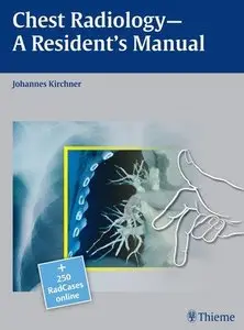 Chest Radiology: A Resident's Manual (Repost)