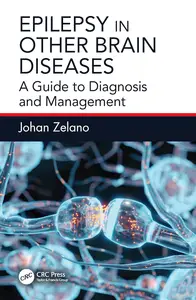 Epilepsy in Other Brain Diseases: A Guide to Diagnosis and Management