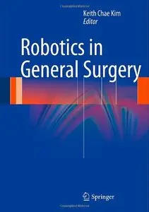 Robotics in General Surgery