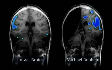 The Secret Life of the Brain (2002) [repost]