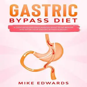 «Gastric Bypass Diet: A Concise Guide for Planning What to Do Before and After your Gastric Bypass Surgery» by Mike Edwa