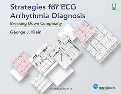 Strategies for ECG Arrhythmia Diagnosis: Breaking Down Complexity