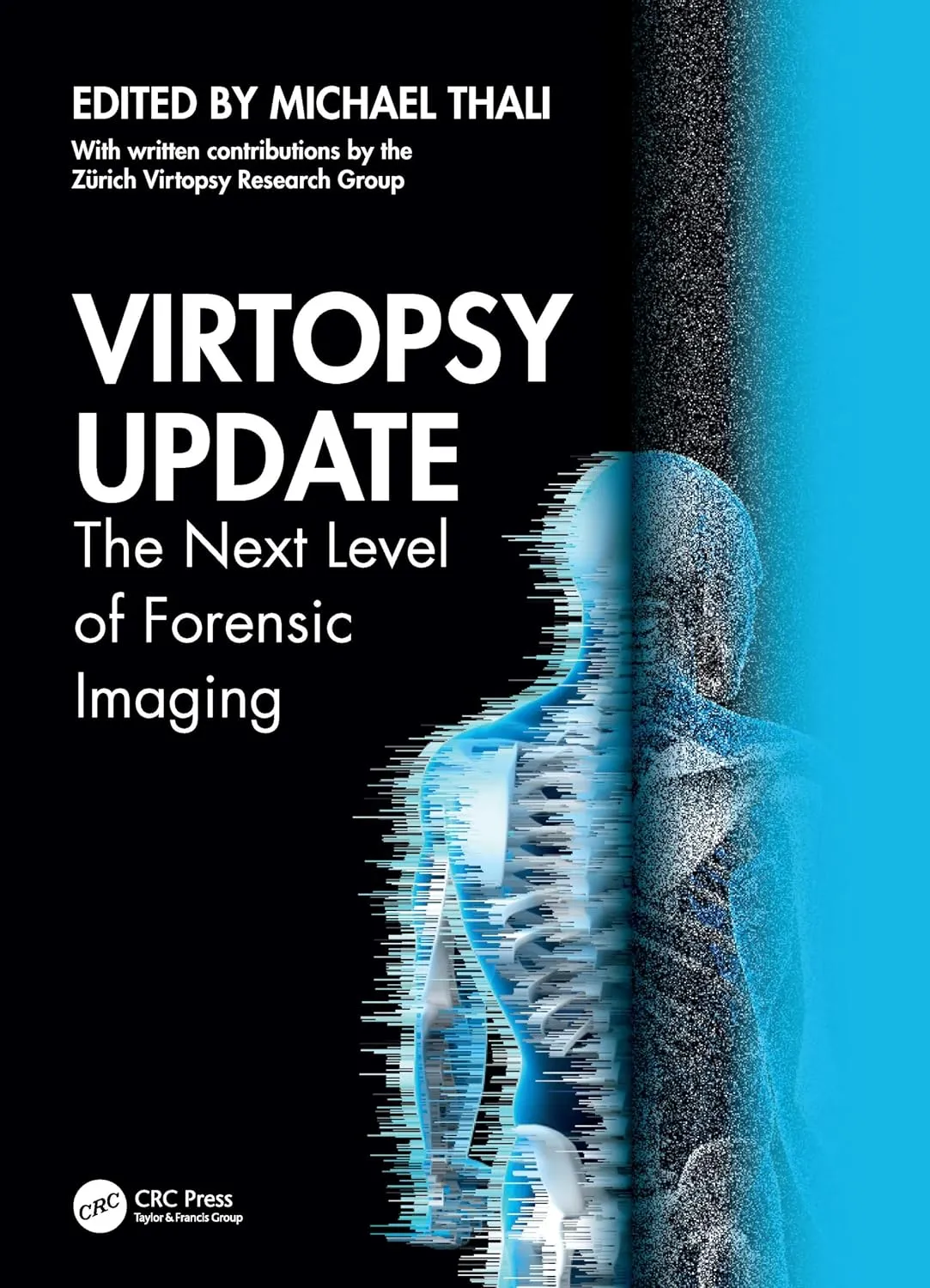 Virtopsy Update: The Next Level of Forensic Imaging
