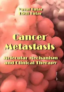 "Cancer Metastasis: Molecular Mechanism and Clinical Therapy" ed. by Yusuf Tutar, Lütfi Tutar