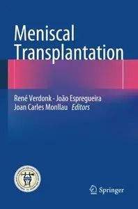 Meniscal Transplantation (repost)