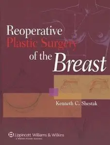 Reoperative Plastic Surgery of the Breast (repost)