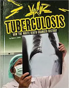 Tuberculosis: How the White Death Changed History